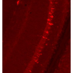 Immunofluorescence Of Transgenic Model Of Neurofibrillary Degeneration