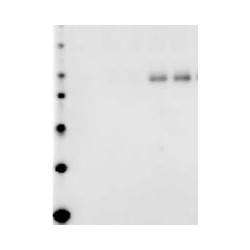 Western-blot de la protéine Tau phosphorylée à la sérine 199