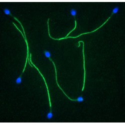 Immunofluorescence (Human spermatozoa)